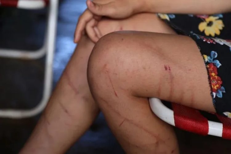 Quedará en prisión preventiva el hombre que torturó, violó e hizo cavar su propia tumba a la victima en Itacaruaré