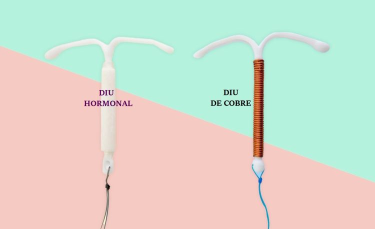 En el marco del SI Mujer recientemente se lanzo a la salud publica el DIU hormonal en Misiones