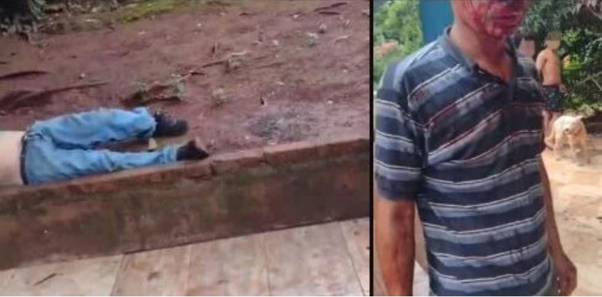 ELDORADO: Dos hermanos se enfrentaron en una violenta discusión que termino a los machetazos