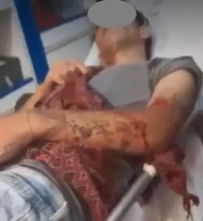 OBERÁ: Una menor apuñaló a su ex novio minutos antes de año nuevo