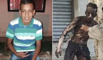 Falleció el joven que terminó con el 90% del cuerpo quemado por robar cables de alta tención en Rosario