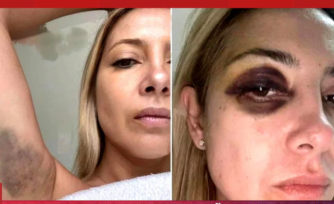 Difundieron las imágenes de Fabiola Yáñez golpeada y chats reveladores
