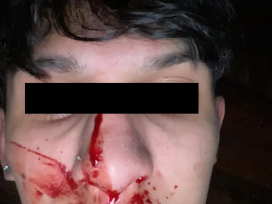 Violencia a la salida de una fiesta de 15, un joven fue atacado y denuncio a un profesor de taekwondo
